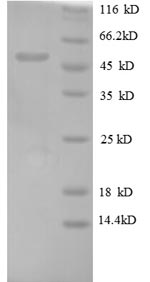 SDS-PAGE- Recombinant protein Human OSM