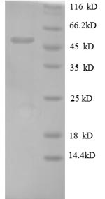 Recombinant Human Oncostatin-M (OSM) - image 1