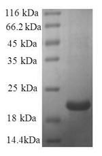 Recombinant Human Galectin-7 (LGALS7) - image 1