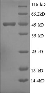 (Tris-Glycine gel) Discontinuous SDS-PAGE (reduced) with 5% enrichment gel and 15% separation gel. (Tris-Glycine gel) Discontinuous SDS-PAGE (reduced) with 5% enrichment gel and 15% separation gel.