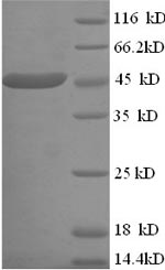 (Tris-Glycine gel) Discontinuous SDS-PAGE (reduced) with 5% enrichment gel and 15% separation gel. (Tris-Glycine gel) Discontinuous SDS-PAGE (reduced) with 5% enrichment gel and 15% separation gel.