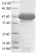 Recombinant Human Stanniocalcin-1 (STC1) , partial - image 1