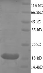 (Tris-Glycine gel) Discontinuous SDS-PAGE (reduced) with 5% enrichment gel and 15% separation gel. (Tris-Glycine gel) Discontinuous SDS-PAGE (reduced) with 5% enrichment gel and 15% separation gel.