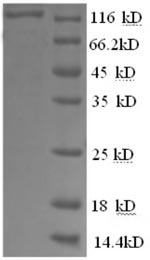 Recombinant Human Glycogen phosphorylase, brain form (PYGB) , partial - image 1