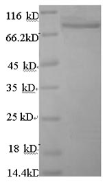(Tris-Glycine gel) Discontinuous SDS-PAGE (reduced) with 5% enrichment gel and 15% separation gel. (Tris-Glycine gel) Discontinuous SDS-PAGE (reduced) with 5% enrichment gel and 15% separation gel.