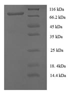 SDS-PAGE- Recombinant protein Human MCAM