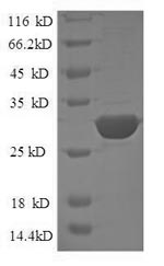 SDS-PAGE- Recombinant protein Human CD24
