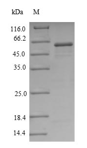 (Tris-Glycine gel) Discontinuous SDS-PAGE (reduced) with 5% enrichment gel and 15% separation gel. (Tris-Glycine gel) Discontinuous SDS-PAGE (reduced) with 5% enrichment gel and 15% separation gel.
