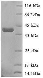 Recombinant Human Golgi membrane protein 1 (GOLM1) , partial - image 1