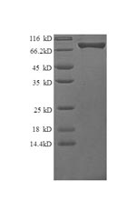SDS-PAGE- Recombinant protein Human CSF3R