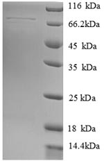 (Tris-Glycine gel) Discontinuous SDS-PAGE (reduced) with 5% enrichment gel and 15% separation gel. (Tris-Glycine gel) Discontinuous SDS-PAGE (reduced) with 5% enrichment gel and 15% separation gel.
