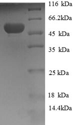 (Tris-Glycine gel) Discontinuous SDS-PAGE (reduced) with 5% enrichment gel and 15% separation gel. (Tris-Glycine gel) Discontinuous SDS-PAGE (reduced) with 5% enrichment gel and 15% separation gel.
