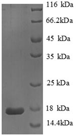 (Tris-Glycine gel) Discontinuous SDS-PAGE (reduced) with 5% enrichment gel and 15% separation gel. (Tris-Glycine gel) Discontinuous SDS-PAGE (reduced) with 5% enrichment gel and 15% separation gel.