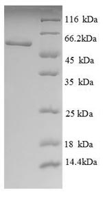 (Tris-Glycine gel) Discontinuous SDS-PAGE (reduced) with 5% enrichment gel and 15% separation gel. (Tris-Glycine gel) Discontinuous SDS-PAGE (reduced) with 5% enrichment gel and 15% separation gel.
