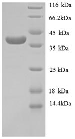 SDS-PAGE - Recombinant Human COL4A1
