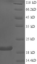 (Tris-Glycine gel) Discontinuous SDS-PAGE (reduced) with 5% enrichment gel and 15% separation gel. (Tris-Glycine gel) Discontinuous SDS-PAGE (reduced) with 5% enrichment gel and 15% separation gel.