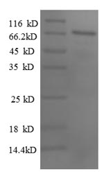(Tris-Glycine gel) Discontinuous SDS-PAGE (reduced) with 5% enrichment gel and 15% separation gel. (Tris-Glycine gel) Discontinuous SDS-PAGE (reduced) with 5% enrichment gel and 15% separation gel.