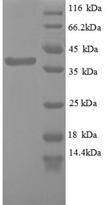 SDS-PAGE- Recombinant protein Human WT1