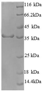 SDS-PAGE- Recombinant protein Human CDK4