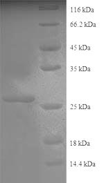 (Tris-Glycine gel) Discontinuous SDS-PAGE (reduced) with 5% enrichment gel and 15% separation gel. (Tris-Glycine gel) Discontinuous SDS-PAGE (reduced) with 5% enrichment gel and 15% separation gel.