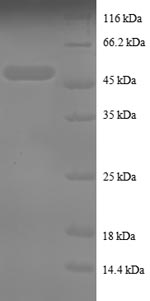 (Tris-Glycine gel) Discontinuous SDS-PAGE (reduced) with 5% enrichment gel and 15% separation gel. (Tris-Glycine gel) Discontinuous SDS-PAGE (reduced) with 5% enrichment gel and 15% separation gel.
