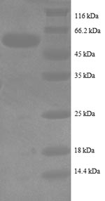 SDS-PAGE- Recombinant protein Human ALPI