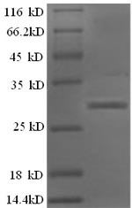 (Tris-Glycine gel) Discontinuous SDS-PAGE (reduced) with 5% enrichment gel and 15% separation gel. (Tris-Glycine gel) Discontinuous SDS-PAGE (reduced) with 5% enrichment gel and 15% separation gel.