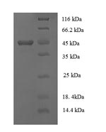 (Tris-Glycine gel) Discontinuous SDS-PAGE (reduced) with 5% enrichment gel and 15% separation gel. (Tris-Glycine gel) Discontinuous SDS-PAGE (reduced) with 5% enrichment gel and 15% separation gel.