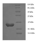 (Tris-Glycine gel) Discontinuous SDS-PAGE (reduced) with 5% enrichment gel and 15% separation gel. (Tris-Glycine gel) Discontinuous SDS-PAGE (reduced) with 5% enrichment gel and 15% separation gel.