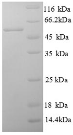 (Tris-Glycine gel) Discontinuous SDS-PAGE (reduced) with 5% enrichment gel and 15% separation gel. (Tris-Glycine gel) Discontinuous SDS-PAGE (reduced) with 5% enrichment gel and 15% separation gel.