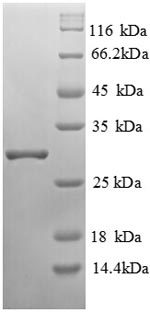 (Tris-Glycine gel) Discontinuous SDS-PAGE (reduced) with 5% enrichment gel and 15% separation gel.