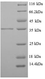 Recombinant Human Tropomyosin beta chain (TPM2) , partial - image 1