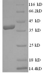 (Tris-Glycine gel) Discontinuous SDS-PAGE (reduced) with 5% enrichment gel and 15% separation gel.