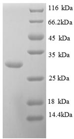 (Tris-Glycine gel) Discontinuous SDS-PAGE (reduced) with 5% enrichment gel and 15% separation gel. (Tris-Glycine gel) Discontinuous SDS-PAGE (reduced) with 5% enrichment gel and 15% separation gel.
