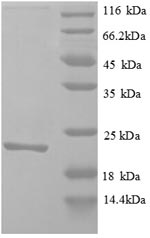 (Tris-Glycine gel) Discontinuous SDS-PAGE (reduced) with 5% enrichment gel and 15% separation gel. (Tris-Glycine gel) Discontinuous SDS-PAGE (reduced) with 5% enrichment gel and 15% separation gel.