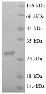 (Tris-Glycine gel) Discontinuous SDS-PAGE (reduced) with 5% enrichment gel and 15% separation gel. (Tris-Glycine gel) Discontinuous SDS-PAGE (reduced) with 5% enrichment gel and 15% separation gel.