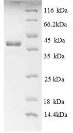 SDS-PAGE- Recombinant protein Human AGER
