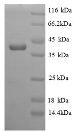 (Tris-Glycine gel) Discontinuous SDS-PAGE (reduced) with 5% enrichment gel and 15% separation gel. (Tris-Glycine gel) Discontinuous SDS-PAGE (reduced) with 5% enrichment gel and 15% separation gel.