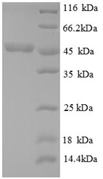 SDS-PAGE- Recombinant protein Escherichia metC