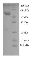 Recombinant Human Zona pellucida sperm-binding protein 3 (ZP3) , partial - image 1