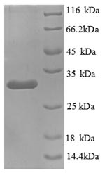 (Tris-Glycine gel) Discontinuous SDS-PAGE (reduced) with 5% enrichment gel and 15% separation gel. (Tris-Glycine gel) Discontinuous SDS-PAGE (reduced) with 5% enrichment gel and 15% separation gel.
