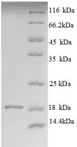 Recombinant Bovine Angiogenin-1 (ANG1) - image 1