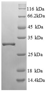 SDS-PAGE- Recombinant protein Human ENPEP