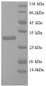(Tris-Glycine gel) Discontinuous SDS-PAGE (reduced) with 5% enrichment gel and 15% separation gel. (Tris-Glycine gel) Discontinuous SDS-PAGE (reduced) with 5% enrichment gel and 15% separation gel.