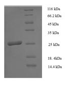 (Tris-Glycine gel) Discontinuous SDS-PAGE (reduced) with 5% enrichment gel and 15% separation gel. (Tris-Glycine gel) Discontinuous SDS-PAGE (reduced) with 5% enrichment gel and 15% separation gel.