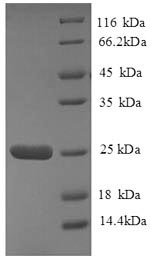 SDS-PAGE- Recombinant protein Human HLA-DQA2