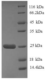 (Tris-Glycine gel) Discontinuous SDS-PAGE (reduced) with 5% enrichment gel and 15% separation gel. (Tris-Glycine gel) Discontinuous SDS-PAGE (reduced) with 5% enrichment gel and 15% separation gel.