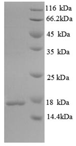 SDS-PAGE- Recombinant protein Mycobacterium mpt63