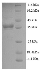 (Tris-Glycine gel) Discontinuous SDS-PAGE (reduced) with 5% enrichment gel and 15% separation gel. (Tris-Glycine gel) Discontinuous SDS-PAGE (reduced) with 5% enrichment gel and 15% separation gel.