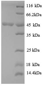 (Tris-Glycine gel) Discontinuous SDS-PAGE (reduced) with 5% enrichment gel and 15% separation gel. (Tris-Glycine gel) Discontinuous SDS-PAGE (reduced) with 5% enrichment gel and 15% separation gel.